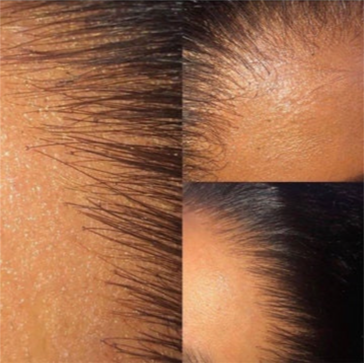 HD Lace Frontal
