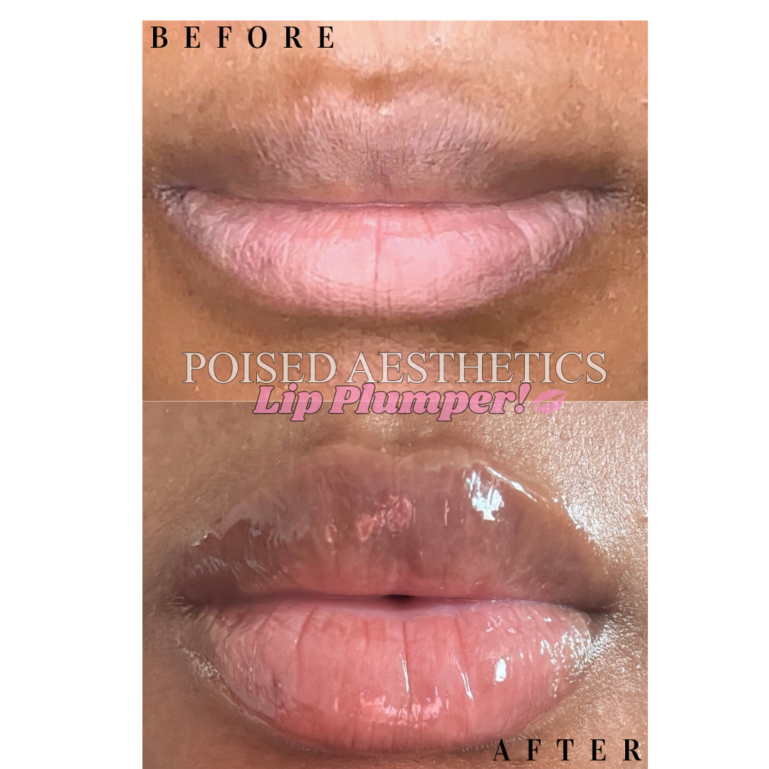 Poised Hydrating Lip Plumper